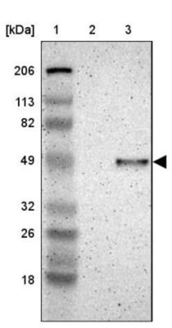 IGSF4B/SynCAM3/CADM3 Antibody, Novus Biologicals:Antibodies:Primary Antibodies