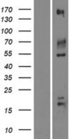 Novus Biologicals™ IGSF9B Overexpression Lysate