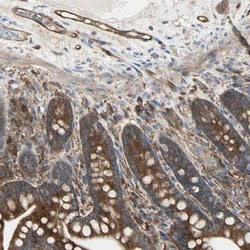 IGSF9B Antibody, Novus Biologicals 25 &mu;L | Buy Online | Novus Biologicals | Fisher Scientific