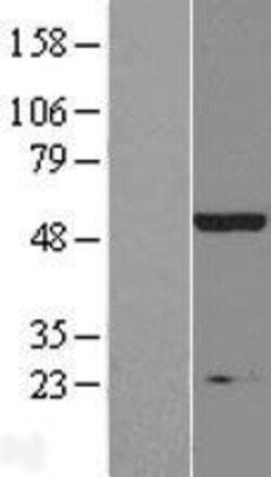 Novus Biologicals&trade;&nbsp;IHPK2 Overexpression Lysate