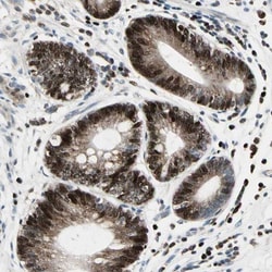 IHPK2 Antibody, Novus Biologicals 0.1mL; Unlabeled:Antibodies, Polyclonal
