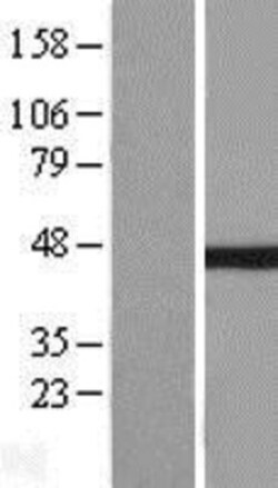 Novus Biologicals&trade;&nbsp;IkB-beta Overexpression Lysate