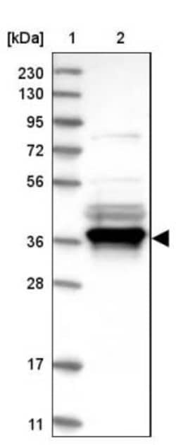 IkB-alpha Antibody, Novus Biologicals 25 &mu;L; Unlabeled:Anticuerpos
