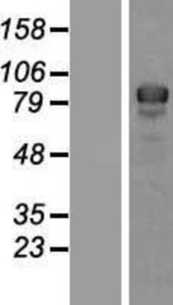 Novus Biologicals&trade;&nbsp;IKK beta Overexpression Lysate
