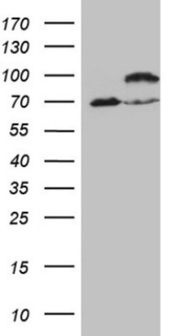 IKK epsilon/IKBKE Antibody (OTI3C5), Novus Biologicals 0.1mL; Unlabeled:Antibodies,