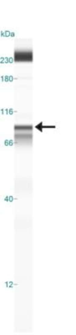 IKK beta Antibody (10A9B6) - BSA Free, Novus Biologicals 0.1mg; Unlabeled:Antibodies,