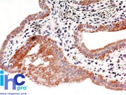 IKK beta Antibody (10AG2) - BSA Free, Novus Biologicals:Antibodies:Primary