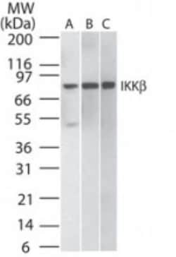 IKK beta Antibody (10AG2) - BSA Free, Novus Biologicals:Antibodies:Primary