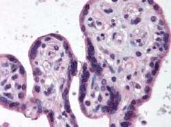 IKK beta Antibody, Novus Biologicals 0.1mL; Unlabeled:Antibodies, Polyclonal