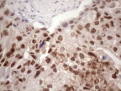 IKK epsilon/IKBKE Antibody (OTI3C5), Novus Biologicals 0.1mL; Unlabeled:Antibodies,