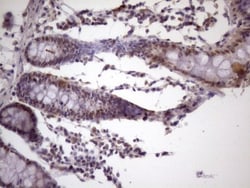 IKK epsilon/IKBKE Antibody (OTI3C5), Novus Biologicals 0.1mL; Unlabeled:Antibodies,