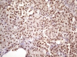 IKK epsilon/IKBKE Antibody (OTI3C5), Novus Biologicals 0.1mL; Unlabeled:Antibodies,