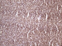 IKK epsilon/IKBKE Antibody (OTI3C5), Novus Biologicals 0.1mL; Unlabeled:Antibodies,