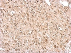 IKK epsilon/IKBKE Antibody, Novus Biologicals 0.1mg; Unlabeled:Antibodies,