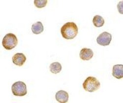 IKK gamma Antibody - BSA Free, Novus Biologicals 0.1mg; Unlabeled:Antibodies,