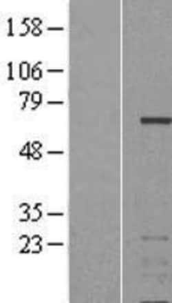 Novus Biologicals&trade;&nbsp;Aiolos/IKZF3 Overexpression Lysate