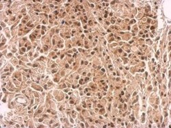 ZNFN1A4 Antibody, Novus Biologicals | Buy Online | Novus Biologicals | Fisher Scientific