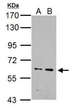 ZNFN1A4 Antibody, Novus Biologicals | Buy Online | Novus Biologicals | Fisher Scientific