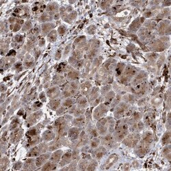 IL1RAPL2 Antibody, Novus Biologicals 0.1mL; Unlabeled:Antibodies, Polyclonal