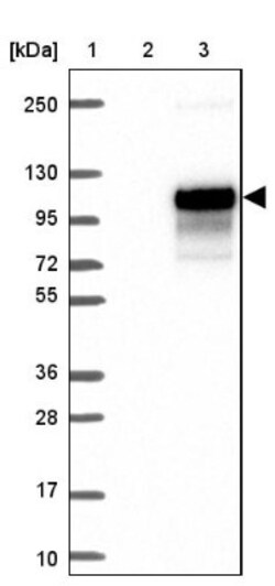 IL1RAPL2 Antibody, Novus Biologicals 25 μL; Unlabeled:Antibodies, Polyclonal