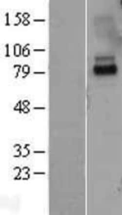 Novus Biologicals&trade;&nbsp;IL-10R alpha Overexpression Lysate