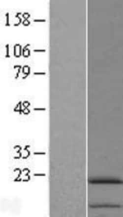 Novus Biologicals&trade;&nbsp;IL-11 Overexpression Lysate