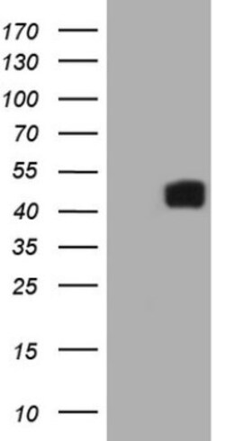 IL12B Antibody (OTI1A3), Novus Biologicals 0.1mL; Unlabeled:Antibodies,
