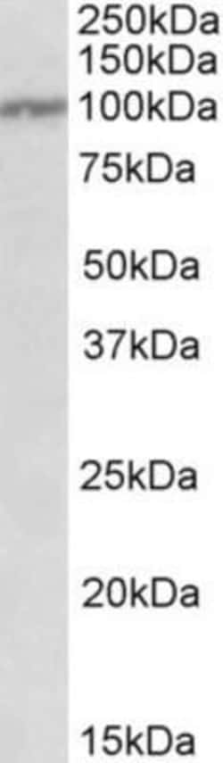 IL-12 R beta 1 Antibody, Novus Biologicals 0.1mg; Unlabeled:Antibodies,