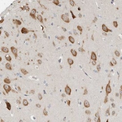 anti-IL-12 R beta 2, Polyclonal, Novus Biologicals 0.1mL; Unlabeled:Antibodies,