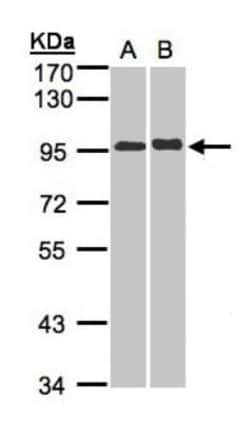 IL-12 R beta 2 Antibody, Novus Biologicals 0.1mg; Unlabeled:Antibodies,
