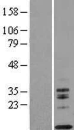 Novus Biologicals&trade;&nbsp;IL-13 Overexpression Lysate