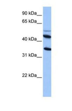 IL-13R alpha 2 Antibody, Novus Biologicals 0.05mg; Unlabeled:Antibodies,