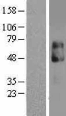 Novus Biologicals™ IL-13R alpha 2 Overexpression Lysate