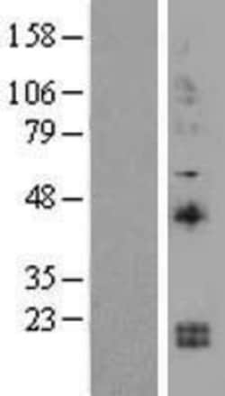Novus Biologicals&trade;&nbsp;IL-15 Overexpression Lysate