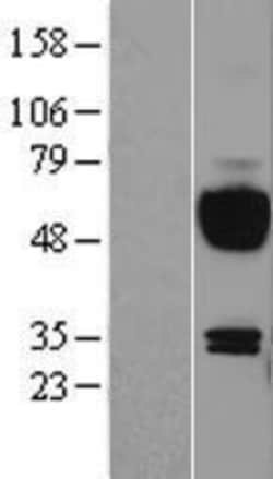 Novus Biologicals&trade;&nbsp;IL-15R alpha Overexpression Lysate