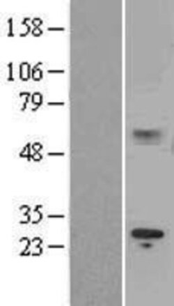 Novus Biologicals&trade;&nbsp;IL-15R alpha Overexpression Lysate