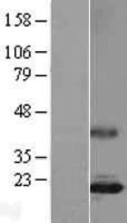 Novus Biologicals™ IL-17/IL-17A Overexpression Lysate
