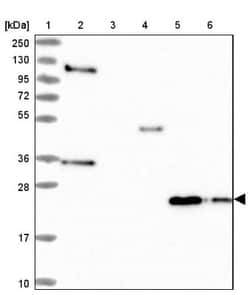 IL-17B Antibody, Novus Biologicals 25 &mu;L; Unlabeled:Antibodies, Polyclonal