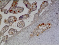 IL-17B Antibody (MM0373-3D62) - Azide and BSA Free, Novus Biologicals 0.1