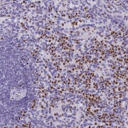 IL-17B Antibody, Novus Biologicals 25 &mu;L; Unlabeled:Antibodies, Polyclonal