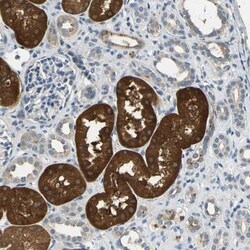 IL-17RB Antibody, Novus Biologicals 0.1mL; Unlabeled:Antibodies, Polyclonal