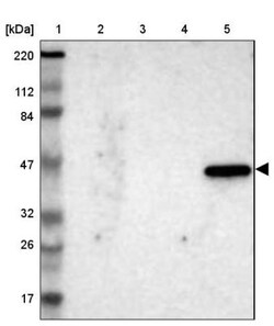 IL-17RB Antibody, Novus Biologicals 0.1mL; Unlabeled:Antibodies, Polyclonal