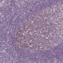 IL-17C Antibody, Novus Biologicals 0.1mL; Unlabeled:Antibodies, Polyclonal
