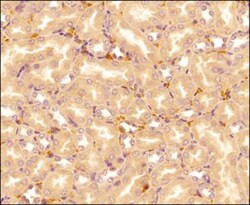 IL-17E/IL-25 Antibody (68C1039.2) - BSA Free, Novus Biologicals:Antibodies:Primary