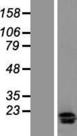 Novus Biologicals&trade;&nbsp;IL-17F Overexpression Lysate