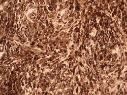 IL-17F Antibody (4H1629.1) - BSA Free, Novus Biologicals:Antibodies:Primary