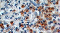 IL-17RA/IL-17R Antibody (49M4D2) - BSA Free, Novus Biologicals 0.025mg;
