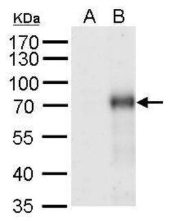 IL-17RB Antibody, Novus Biologicals 0.1mL:Antibodies, Polyclonal