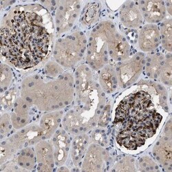 IL-17RE Antibody, Novus Biologicals 25 &mu;L | Buy Online | Novus Biologicals | Fisher Scientific