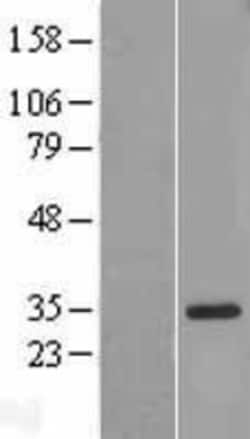 Novus Biologicals&trade;&nbsp;IL-18 BPa/IL18BP Overexpression Lysate